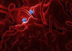 Influencia de la metformina sobre la microbiota intestinal